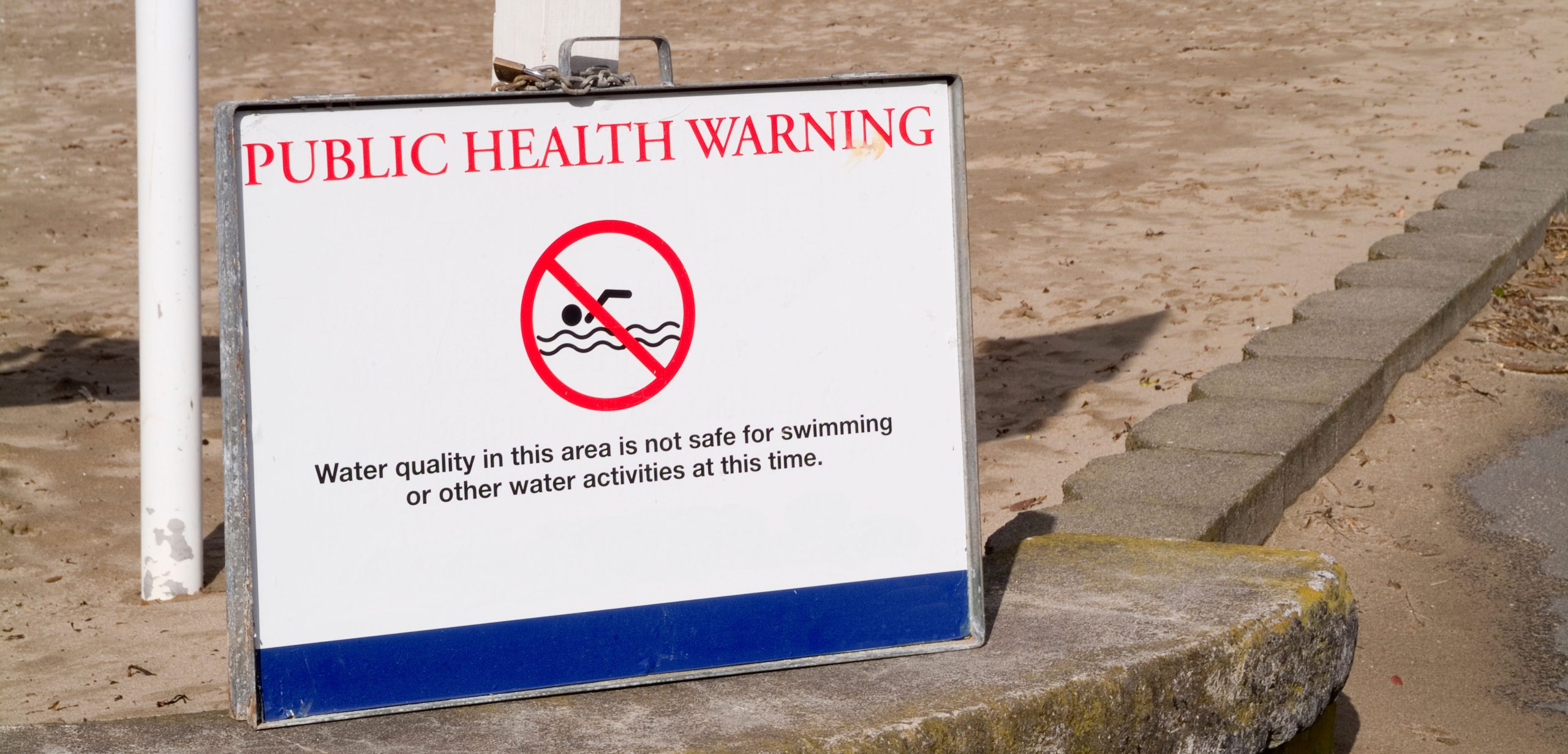 Watch out for fecal bacteria in the sand. Photo by Karel Lorier/Alamy Stock Photo