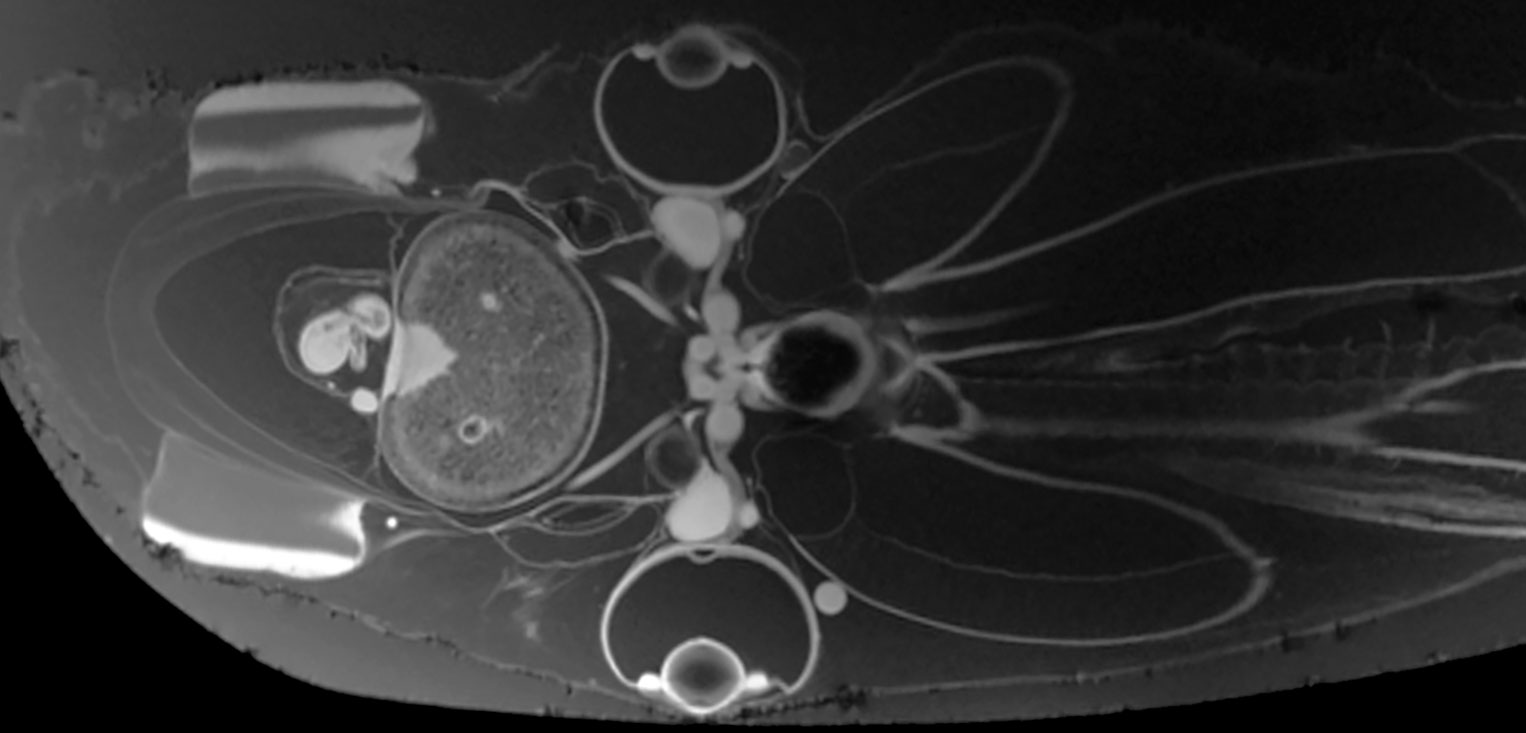 MRI scan of emperor Dumbo octopus