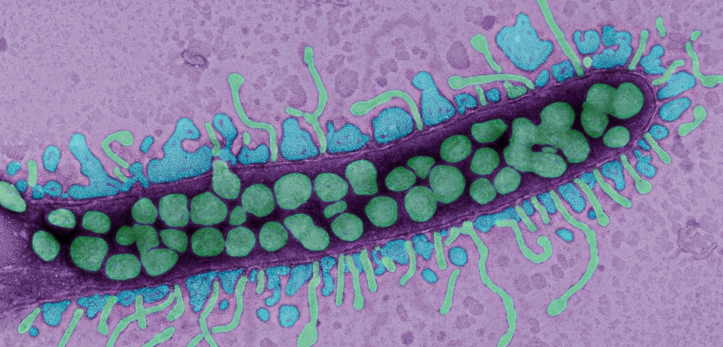 Pelagiphage virus infecting bacterium, TEM