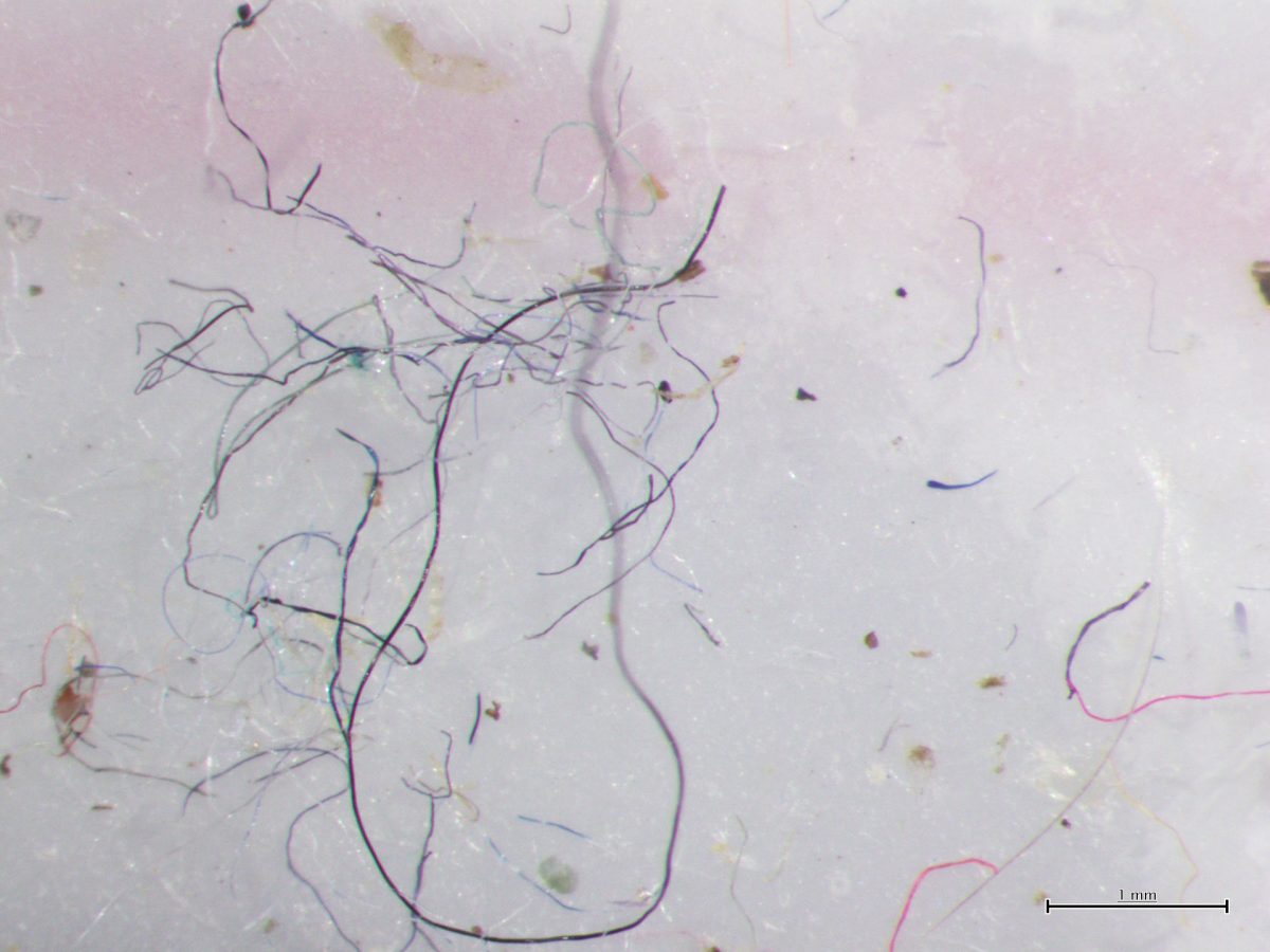 These microfibers are ubiquitous in the ocean, from the deepest waters to the surface waves. Photo courtesy of the Ocean Wise Conservation Association