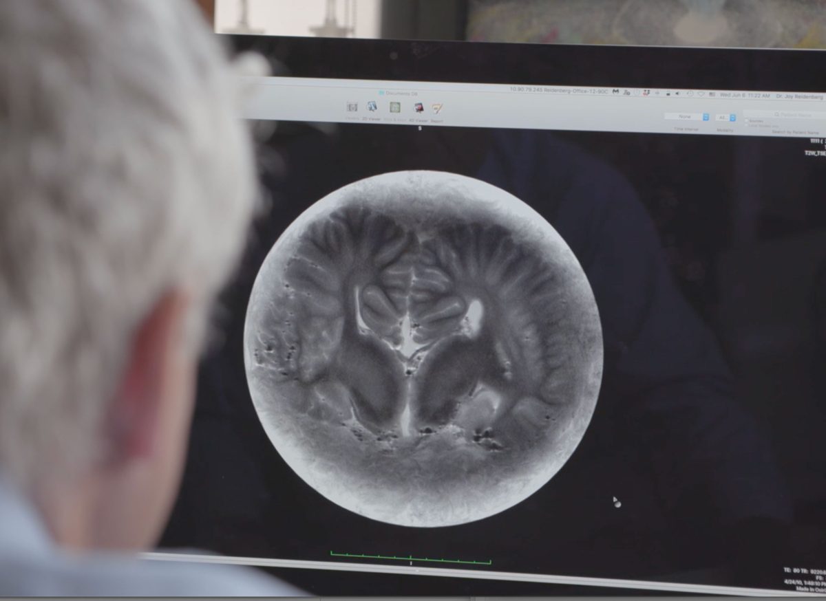 MRI image of whale brain