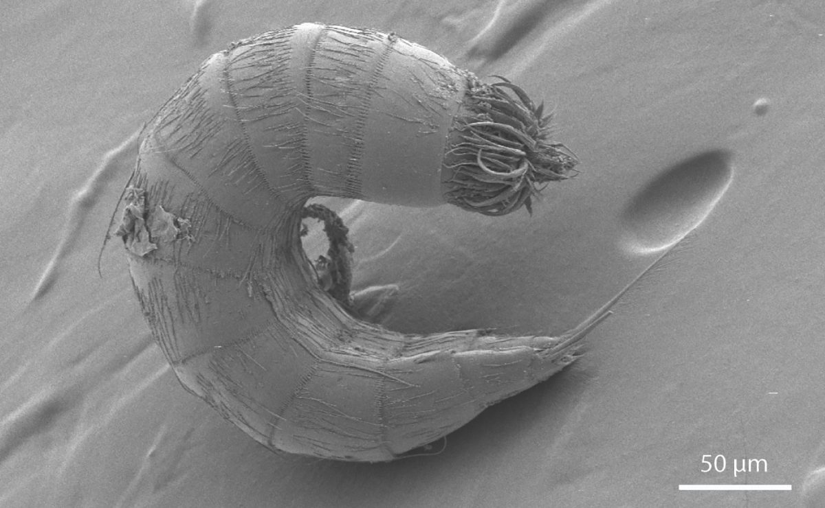 A scanning electron micrograph of a kinorhynch or mud dragon